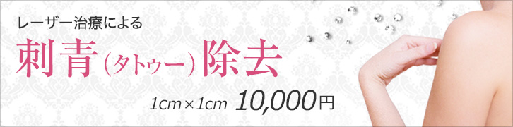 レーザー治療による刺青（タトゥー除去）1cm✕1cm 10,000円